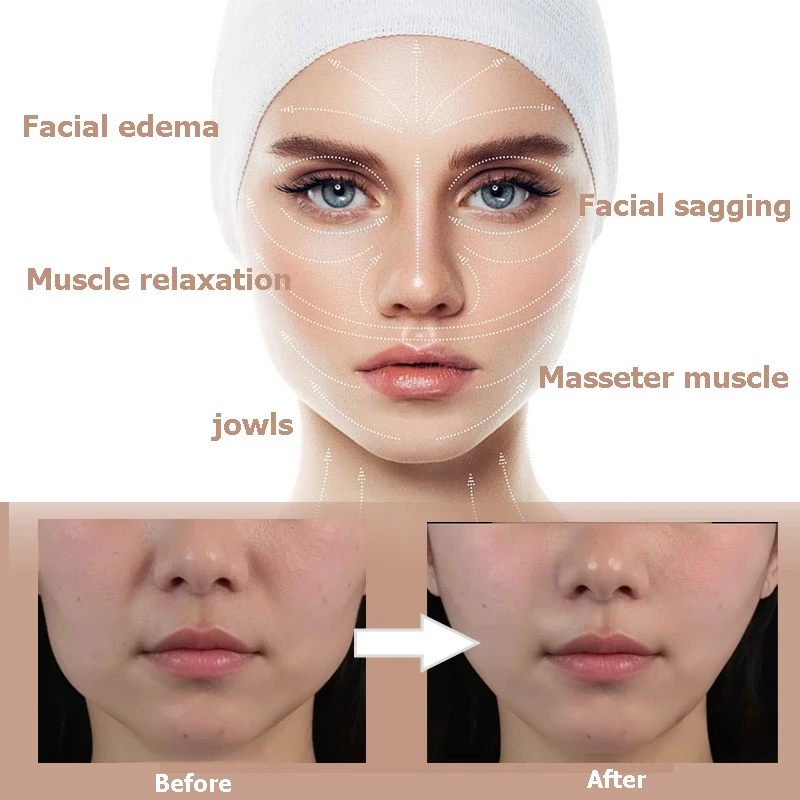 แผ่นยกกระชับใบหน้า 120/80/40 แ - Makeup Beauty Ro บทวิจารณ์และราคา